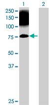 Western blot - Munc18-1 overexpression 293T lysate (whole cell) (AB94272)