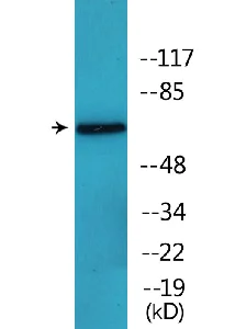 Western blot - Anti-Munc18-1 (phospho S313) antibody (AB138687)