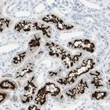 Immunohistochemistry (Formalin/PFA-fixed paraffin-embedded sections) - Anti-MUPCDH antibody (AB121306)