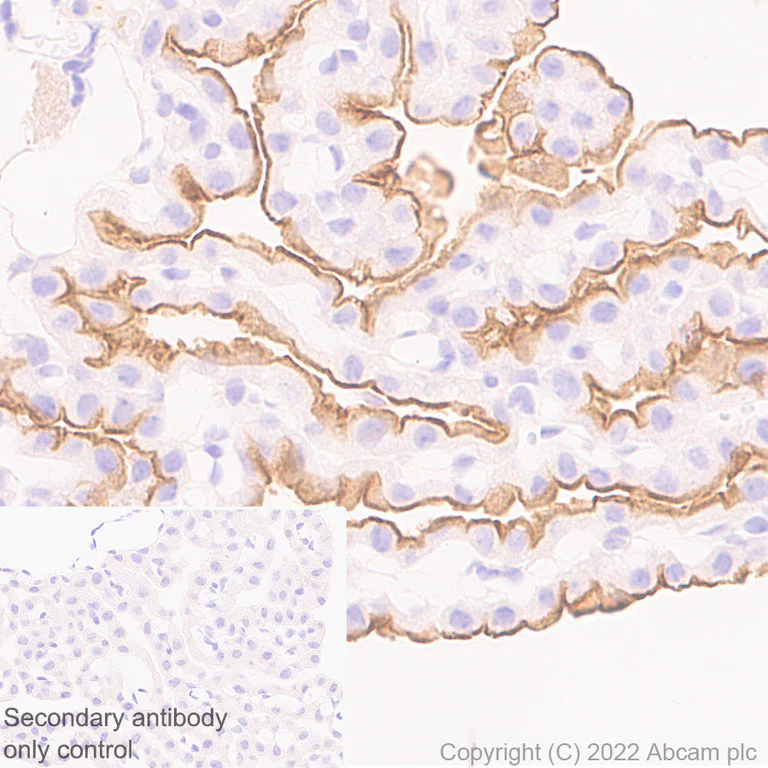 Immunohistochemistry (Formalin/PFA-fixed paraffin-embedded sections) - Anti-MUPP1 antibody [EPR26317-59] (AB302621)