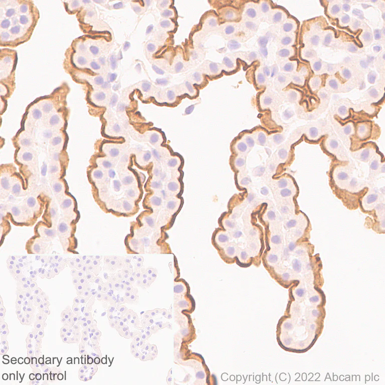 Immunohistochemistry (Formalin/PFA-fixed paraffin-embedded sections) - Anti-MUPP1 antibody [EPR26317-59] (AB302621)