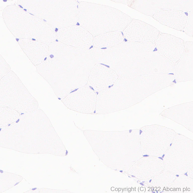Immunohistochemistry (Formalin/PFA-fixed paraffin-embedded sections) - Anti-MUPP1 antibody [EPR26317-59] (AB302621)