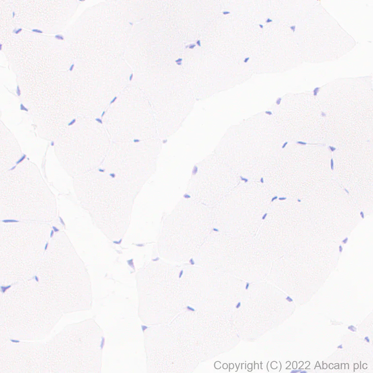 Immunohistochemistry (Formalin/PFA-fixed paraffin-embedded sections) - Anti-MUPP1 antibody [EPR26317-59] (AB302621)