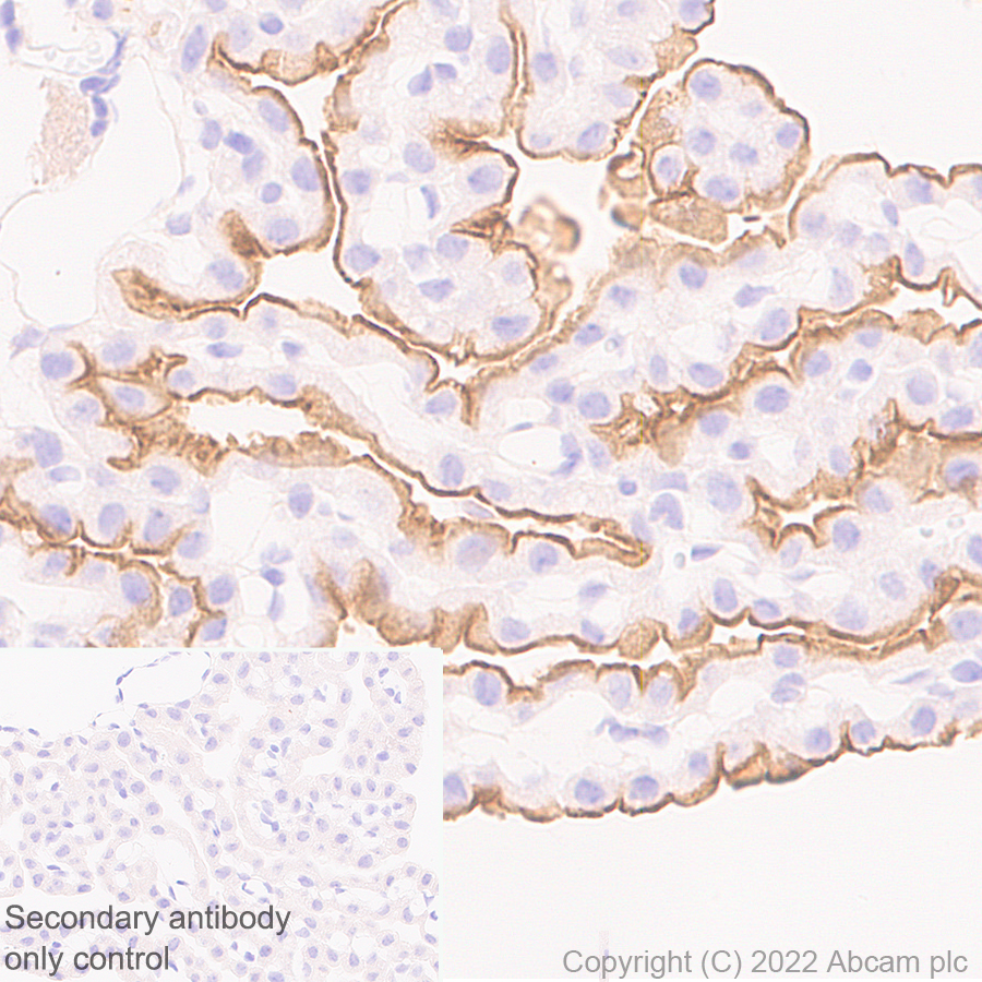 Immunohistochemistry (Formalin/PFA-fixed paraffin-embedded sections) - Anti-MUPP1 antibody [EPR26317-59] (BSA and Azide free) (ab302622), expandable thumbnail