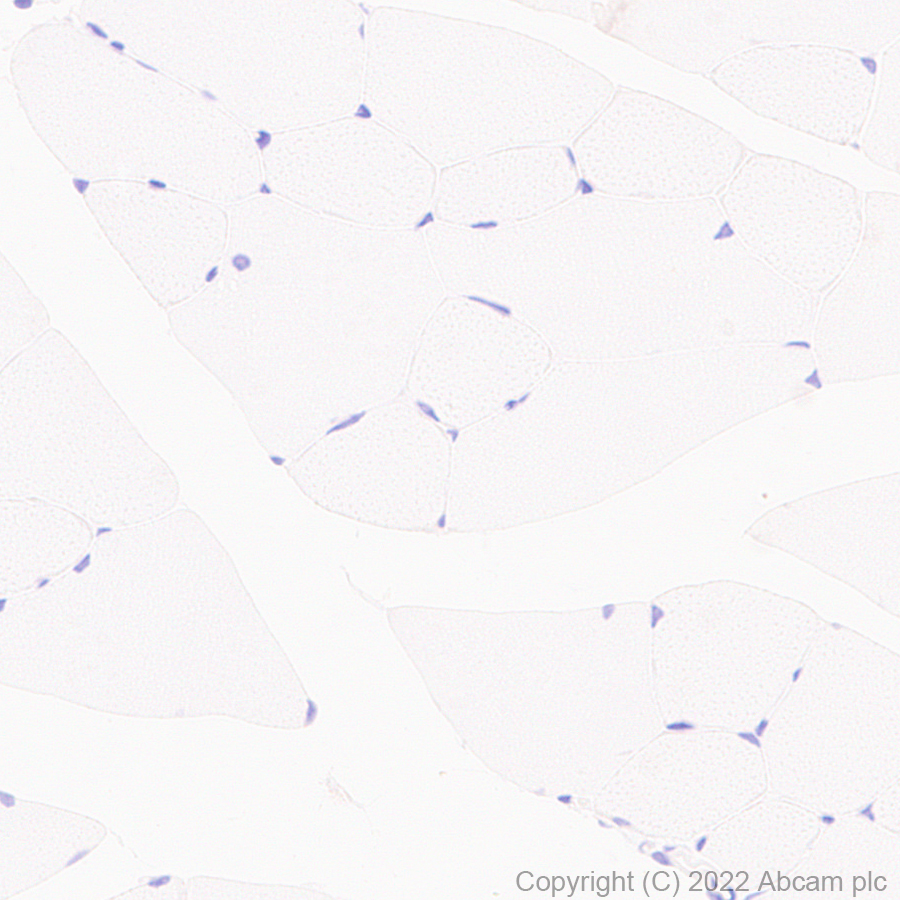Immunohistochemistry (Formalin/PFA-fixed paraffin-embedded sections) - Anti-MUPP1 antibody [EPR26317-59] (BSA and Azide free) (ab302622), expandable thumbnail