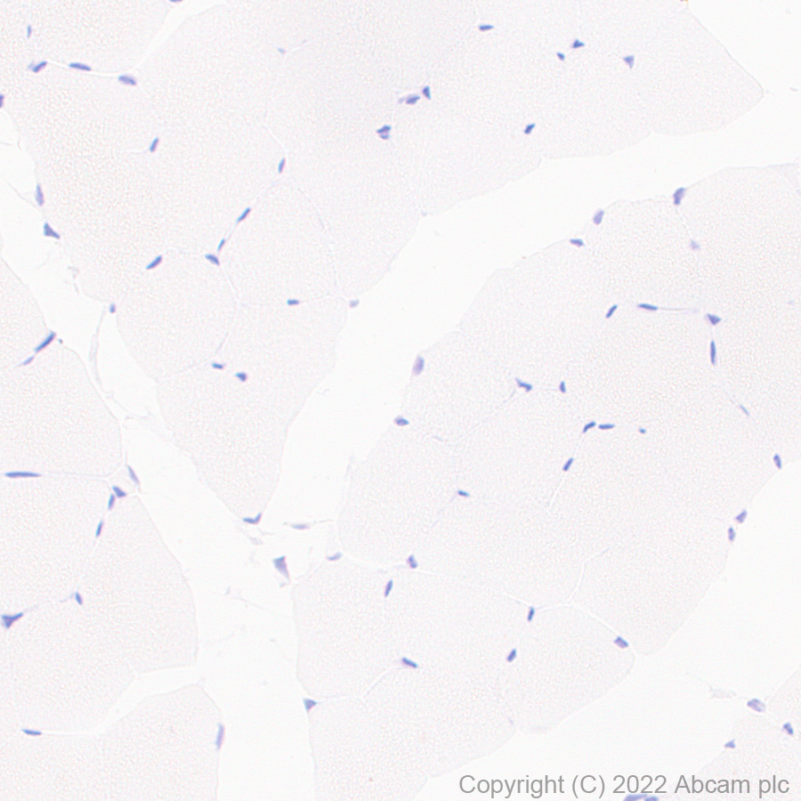 Immunohistochemistry (Formalin/PFA-fixed paraffin-embedded sections) - Anti-MUPP1 antibody [EPR26317-59] (BSA and Azide free) (ab302622), expandable thumbnail