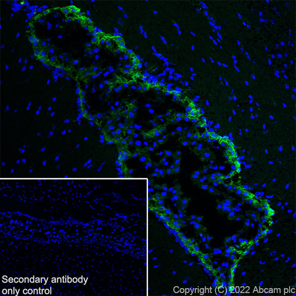 Immunohistochemistry (Frozen sections) - Anti-MUPP1 antibody [EPR26317-59] (BSA and Azide free) (AB302622), expandable thumbnail