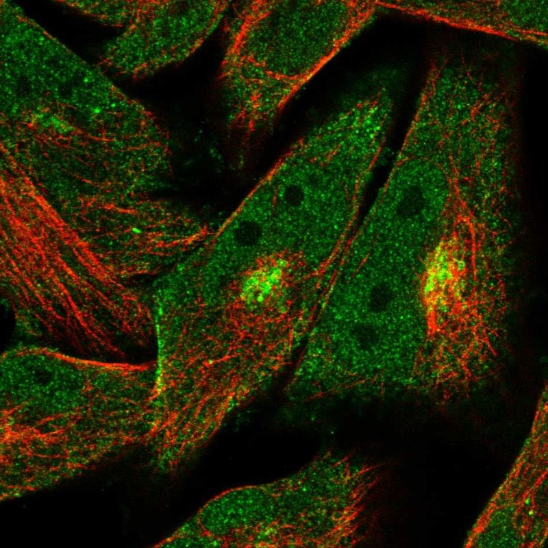Immunocytochemistry/ Immunofluorescence - Anti-MURC antibody (AB121642), expandable thumbnail