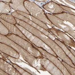 Immunohistochemistry (Formalin/PFA-fixed paraffin-embedded sections) - Anti-MURC antibody (AB121642), expandable thumbnail