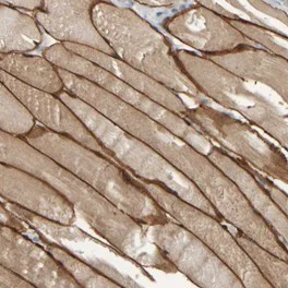 Immunohistochemistry (Formalin/PFA-fixed paraffin-embedded sections) - Anti-MURC antibody (AB121642)