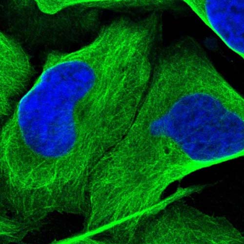 Immunocytochemistry/ Immunofluorescence - Anti-MURC antibody (AB121647), expandable thumbnail