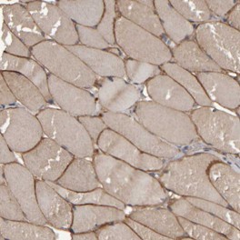 Immunohistochemistry (Formalin/PFA-fixed paraffin-embedded sections) - Anti-MURC antibody (AB121647), expandable thumbnail