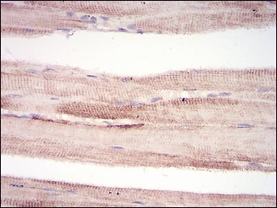 Immunohistochemistry (Formalin/PFA-fixed paraffin-embedded sections) - Anti-MURF1 antibody [7B8E1] (AB201941), expandable thumbnail