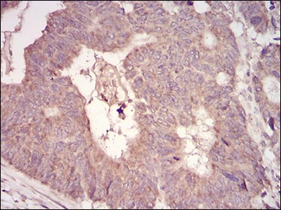 Immunohistochemistry (Formalin/PFA-fixed paraffin-embedded sections) - Anti-MURF1 antibody [7B8E1] (AB201941), expandable thumbnail