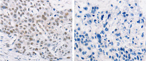 Immunohistochemistry (Formalin/PFA-fixed paraffin-embedded sections) - Anti-MURF1 antibody (AB183094)