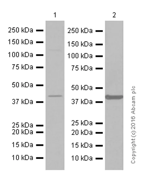 Western blot - Anti-MURF1 + MURF3 + MURF2 antibody [EPR6431(2)] (AB172479)
