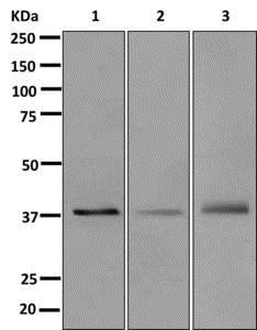Western blot - Anti-MURF1 + MURF3 + MURF2 antibody [EPR6431(2)] (AB172479), expandable thumbnail