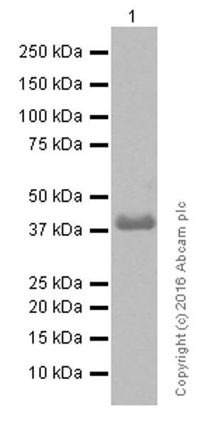 Western blot - Anti-MURF1 + MURF3 + MURF2 antibody [EPR6431(2)] (ab172479), expandable thumbnail