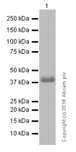 Western blot - Anti-MURF1 + MURF3 + MURF2 antibody [EPR6431(2)] - BSA and Azide free (AB232364)