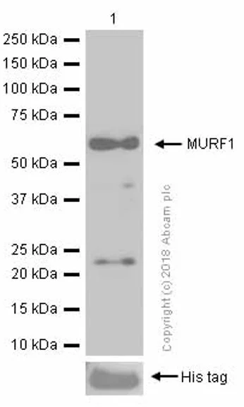 Western blot - Anti-MURF1 + MURF3 + MURF2 antibody [EPR6431(2)] - BSA and Azide free (AB232364)