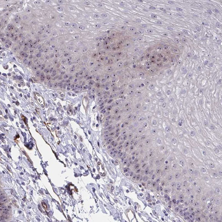 Immunohistochemistry (Formalin/PFA-fixed paraffin-embedded sections) - Anti-Mus81 antibody (AB247136)
