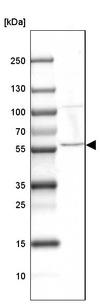 Western blot - Anti-Mus81 antibody (AB247136)