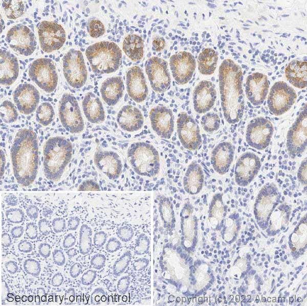 Immunohistochemistry (Formalin/PFA-fixed paraffin-embedded sections) - Anti-Musashi 1 / Msi1 antibody (AB21628), expandable thumbnail