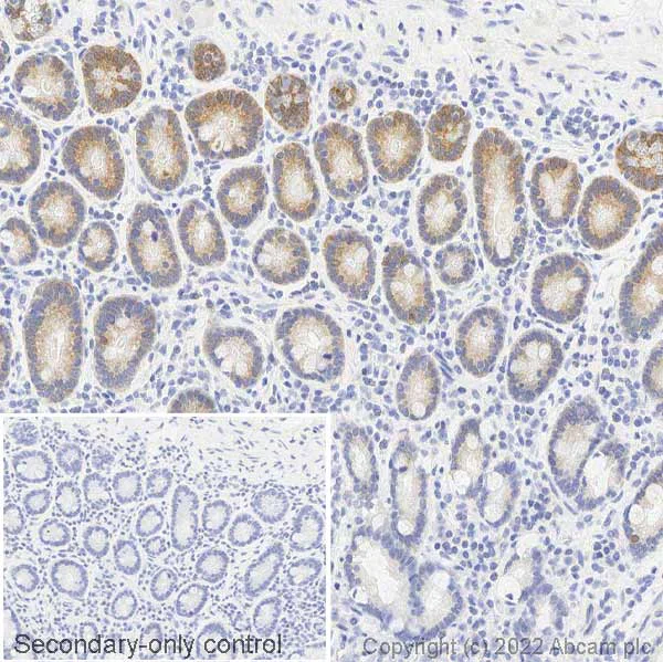 Immunohistochemistry (Formalin/PFA-fixed paraffin-embedded sections) - Anti-Musashi 1 / Msi1 antibody (AB21628)