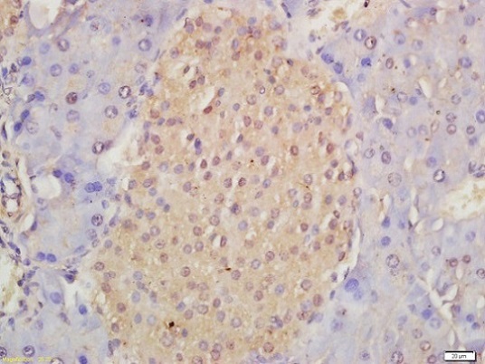 Immunohistochemistry (Formalin/PFA-fixed paraffin-embedded sections) - Anti-Musashi 1 / Msi1 antibody (AB218189), expandable thumbnail