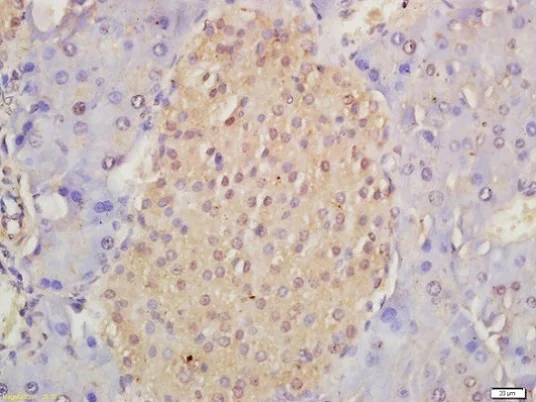 Immunohistochemistry (Formalin/PFA-fixed paraffin-embedded sections) - Anti-Musashi 1 / Msi1 antibody (AB218189)