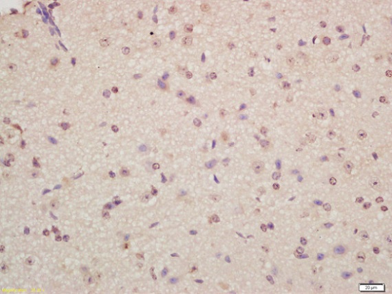 Immunohistochemistry (Formalin/PFA-fixed paraffin-embedded sections) - Anti-Musashi 1 / Msi1 antibody (AB218189), expandable thumbnail