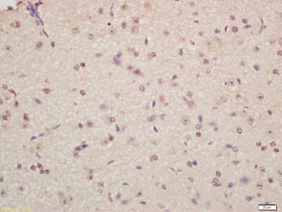 Immunohistochemistry (Formalin/PFA-fixed paraffin-embedded sections) - Anti-Musashi 1 / Msi1 antibody (AB218189)