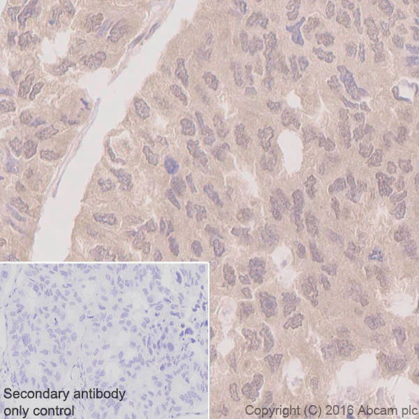 Anti-Musashi 1 / Msi1 antibody [EP1302] (ab52865) | Abcam