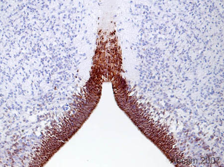 Immunohistochemistry (Formalin/PFA-fixed paraffin-embedded sections) - Anti-Musashi 1 / Msi1 antibody [EP1302] - BSA and Azide free (ab221797), expandable thumbnail