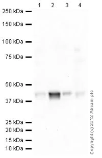 Western blot - Anti-Musashi 1 / Msi1 antibody [Y2709] (AB129819)