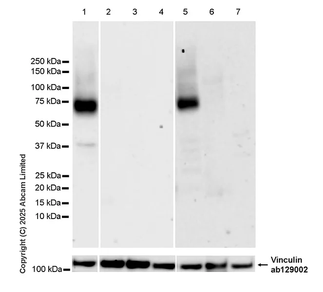 Western blot - Anti-Muscarinic Acetylcholine Receptor 1/CHRM1 antibody [EPR26494-240] (AB325432)