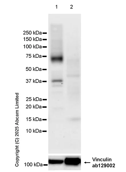 Western blot - Anti-Muscarinic Acetylcholine Receptor 1/CHRM1 antibody [EPR26494-240] (AB325432)