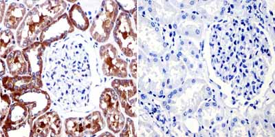 Immunohistochemistry (Formalin/PFA-fixed paraffin-embedded sections) - Anti-Muscarinic Acetylcholine Receptor 2/CM2 antibody [31-1D1] (AB2805)