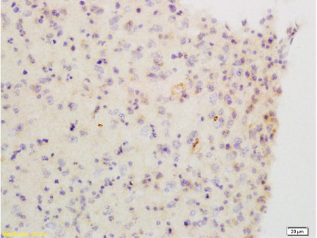 Immunohistochemistry (Formalin/PFA-fixed paraffin-embedded sections) - Anti-Muscarinic Acetylcholine Receptor 2/CM2 antibody (AB216641), expandable thumbnail