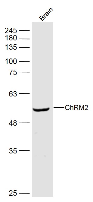 Western blot - Anti-Muscarinic Acetylcholine Receptor 2/CM2 antibody (AB216641), expandable thumbnail