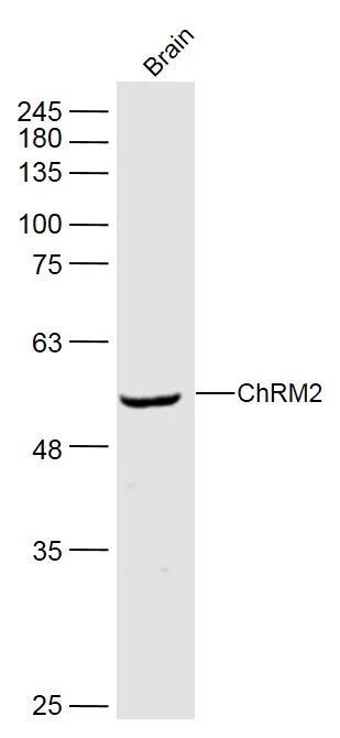 Western blot - Anti-Muscarinic Acetylcholine Receptor 2/CM2 antibody (AB216641)