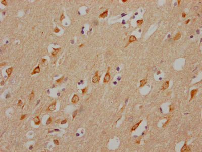 Immunohistochemistry (Formalin/PFA-fixed paraffin-embedded sections) - Anti-Muscarinic Acetylcholine Receptor M3/CHRM3 antibody [2D4] (AB314013)