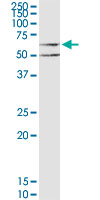 Western blot - Anti-Muscarinic Acetylcholine Receptor M3/CHRM3 antibody (AB167566), expandable thumbnail