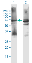 Western blot - Anti-Muscarinic Acetylcholine Receptor M3/CHRM3 antibody (AB167566), expandable thumbnail
