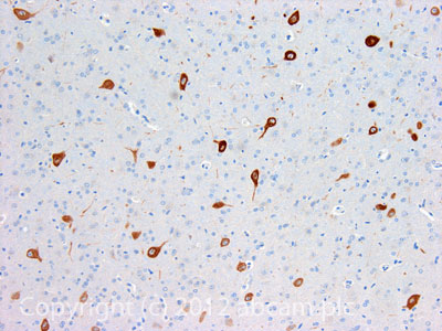 Immunohistochemistry (Formalin/PFA-fixed paraffin-embedded sections) - Anti-Muscarinic Acetylcholine Receptor M3/CHRM3 antibody (AB87199)