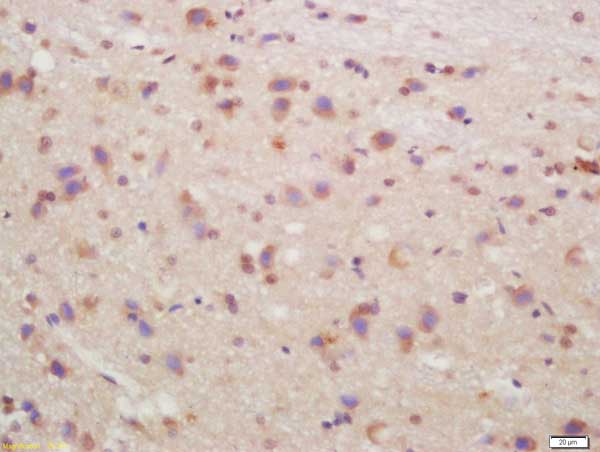 Immunohistochemistry (Formalin/PFA-fixed paraffin-embedded sections) - Anti-Muscarinic Acetylcholine Receptor M4/CHRM4 antibody (AB214458), expandable thumbnail