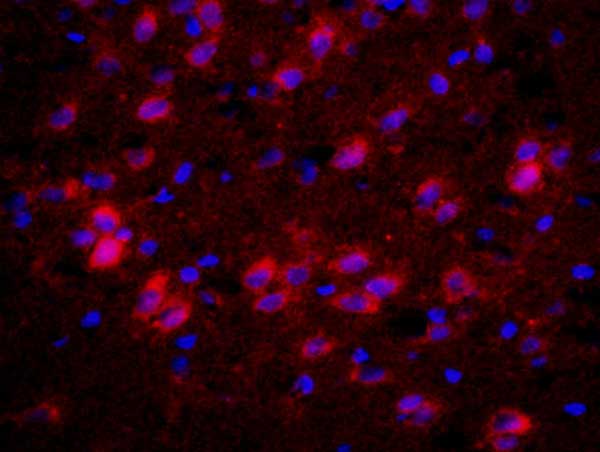 Immunohistochemistry (Formalin/PFA-fixed paraffin-embedded sections) - Anti-Muscarinic Acetylcholine Receptor M4/CHRM4 antibody (AB214458), expandable thumbnail