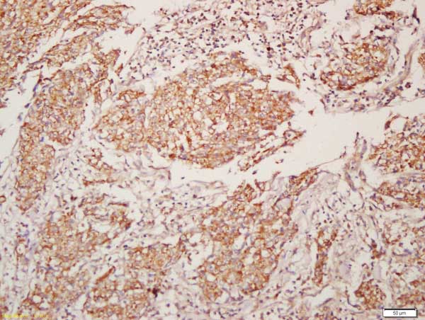Immunohistochemistry (Formalin/PFA-fixed paraffin-embedded sections) - Anti-Muscarinic Acetylcholine Receptor M4/CHRM4 antibody (AB214458), expandable thumbnail