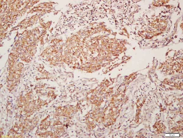 Immunohistochemistry (Formalin/PFA-fixed paraffin-embedded sections) - Anti-Muscarinic Acetylcholine Receptor M4/CHRM4 antibody (AB214458)