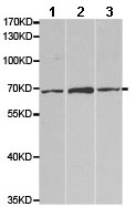 Western blot - Anti-Muscarinic Acetylcholine Receptor M5/CHRM5 antibody (AB186830)